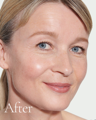 after2 block Close up portrait of model after application  of T6.5 with text stating 'After'