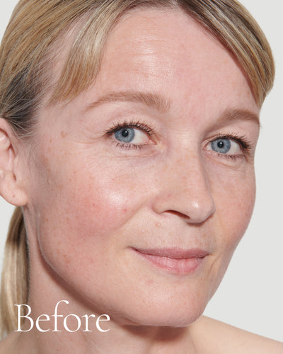 before2 block  Close up portrait of model before wearing Tint with text stating 'Before'