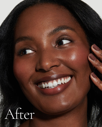 after1 block Close up portrait of model after application  of T15 with text stating 'After'