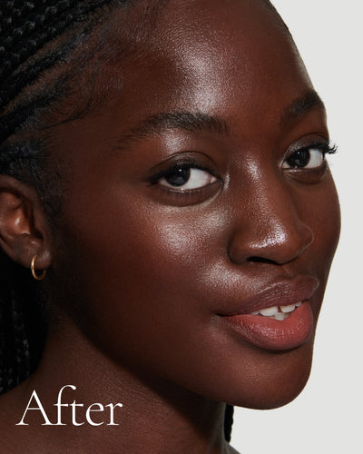 before1 block Close up portrait of model after application  of T17 with text stating 'After'