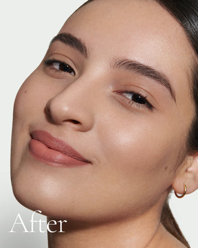 after1 block Close up portrait of model after application  of T5 with text stating 'After'