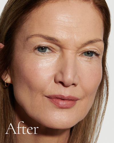 after2 block Close up portrait of model after application  of T7 with text stating 'After'