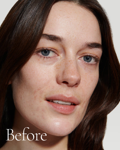 before1 block  Close up portrait of model before wearing Tint with text stating 'Before'