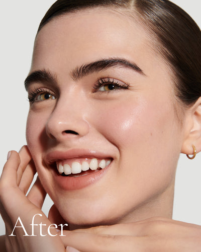 after1 block Close up portrait of model after application  of T4 with text stating 'After'